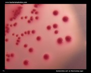 escherichia on Mac Conkey agar